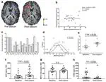Dynamic Blood-Brain Barrier Regulation in Mild Traumatic Brain Injury