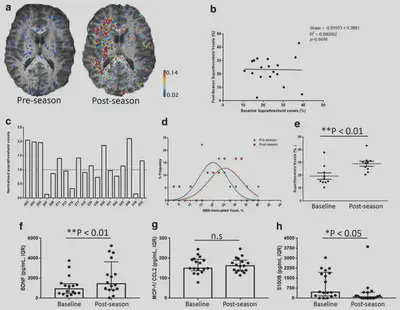 Blood-brain barrier disruption patterns after repetitive head impacts.