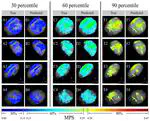 Rapid Estimation of Entire Brain Strain Using Deep Learning Models