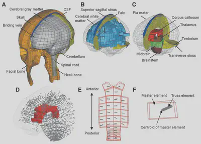 Finite element head model and tract-related deformation components.