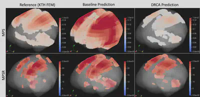 Brain deformation prediction using adaptive machine learning head models.