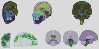 Representative finite element head models for traumatic brain injury research.