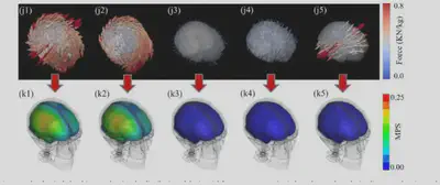 Inertial force components and corresponding brain strain distributions.